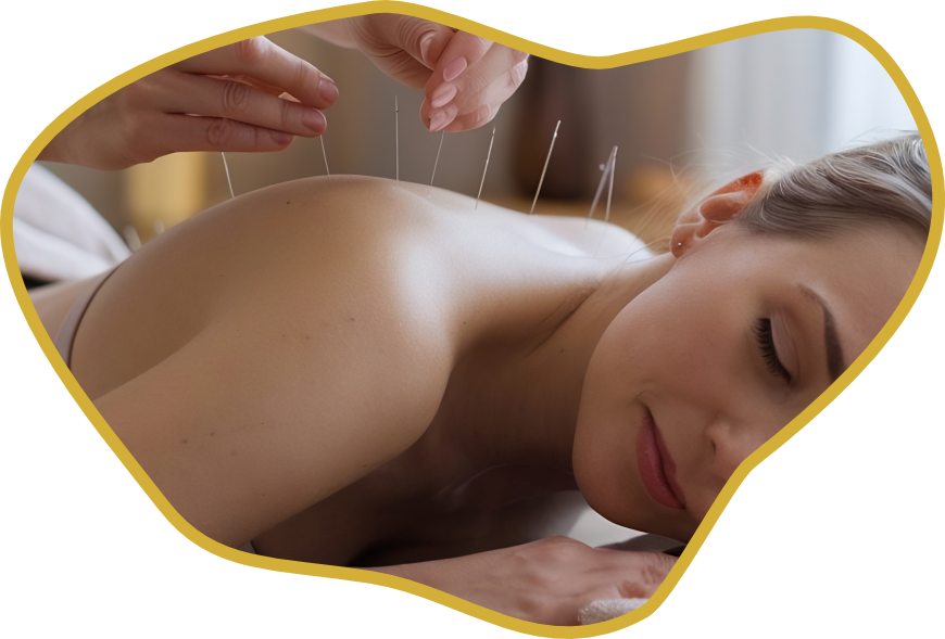 Acupuntura Bem Estar