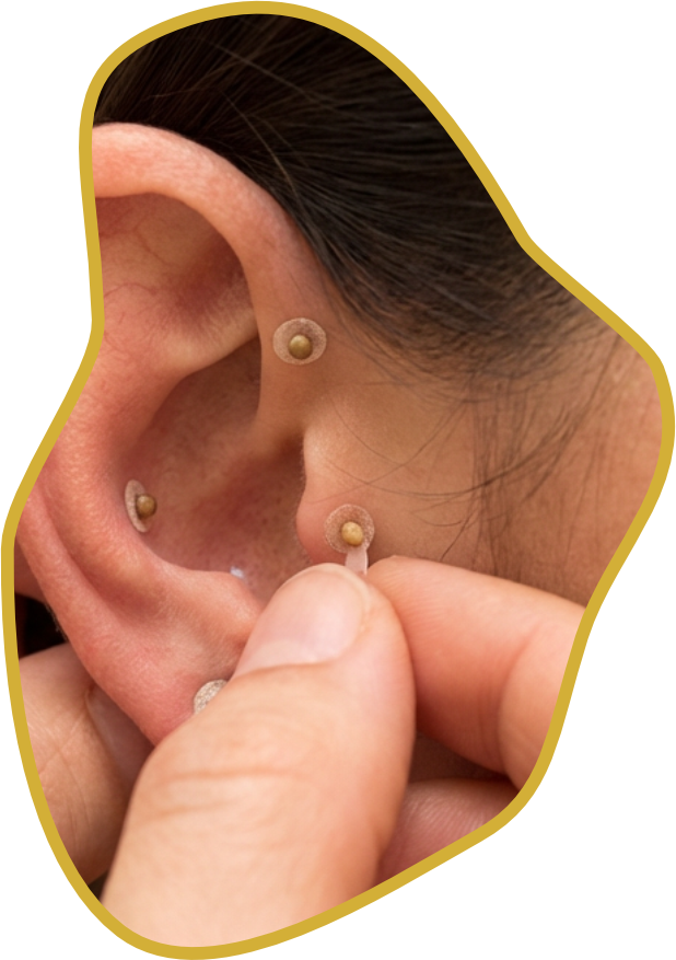 Auriculoterapia e Terapia Auricular