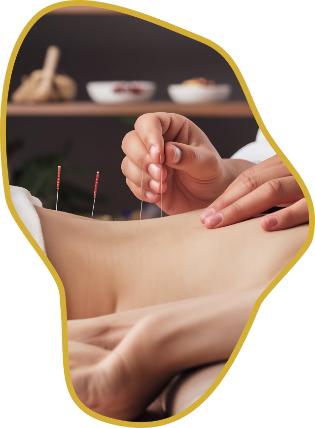 O que e Acupuntura 1