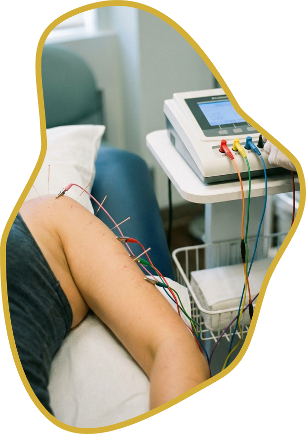 O que e a Eletroacupuntura