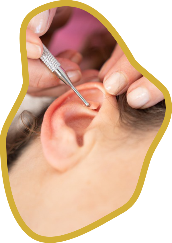 Auriculoterapia e Terapia Auricular